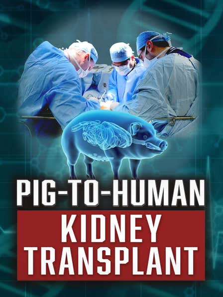 Pig-to-Human Kidney Transplant dcg-mark-poster